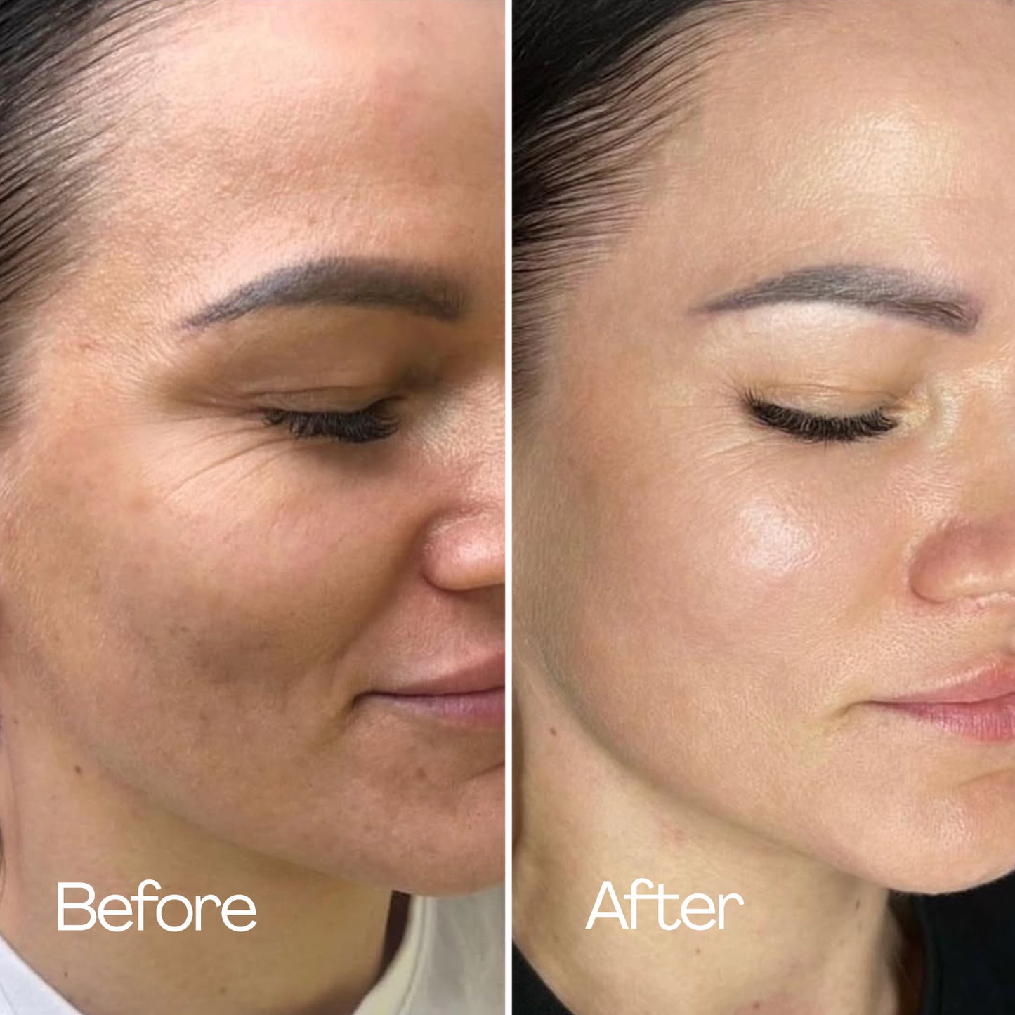 HydroGlow Anti-Aging Mask