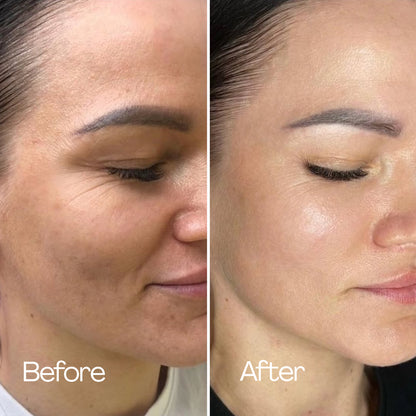 HydroGlow Anti-Aging Mask